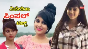 Niveditha Gowda: ಪಿಂಪಲ್ ಆದ್ರೆ ನಿವೇದಿತಾ ಗೌಡ ಏನ್ಮಾಡ್ತಾರೆ? ಮನೆಯಲ್ಲೇ ಸಿಗೋ ಈ 2 ವಸ್ತು ಇದ್ರೆ ಮೊಡವೆ ಮಾಯ | Niveditha Gowda pimple curing tips | | ACTPnews