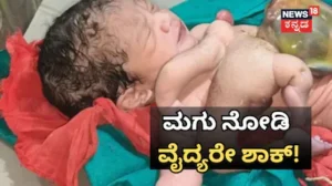 Viral Baby: 4 ಕೈ-ಕಾಲುಗಳು ಮತ್ತು ಹೆಚ್ಚುವರಿ ಮುಂಡದೊಂದಿಗೆ ಮಗು ಜನನ! ವೈದ್ಯರು ಹೇಳಿದ್ದೇನು ಗೊತ್ತಾ? / Viral Baby: Baby Born With Four Limbs and an Extra body! | ರಾಷ್ಟ್ರೀಯ ಮತ್ತು ಅಂತಾರಾಷ್ಟ್ರೀಯ ಸುದ್ದಿ | ACTPnews